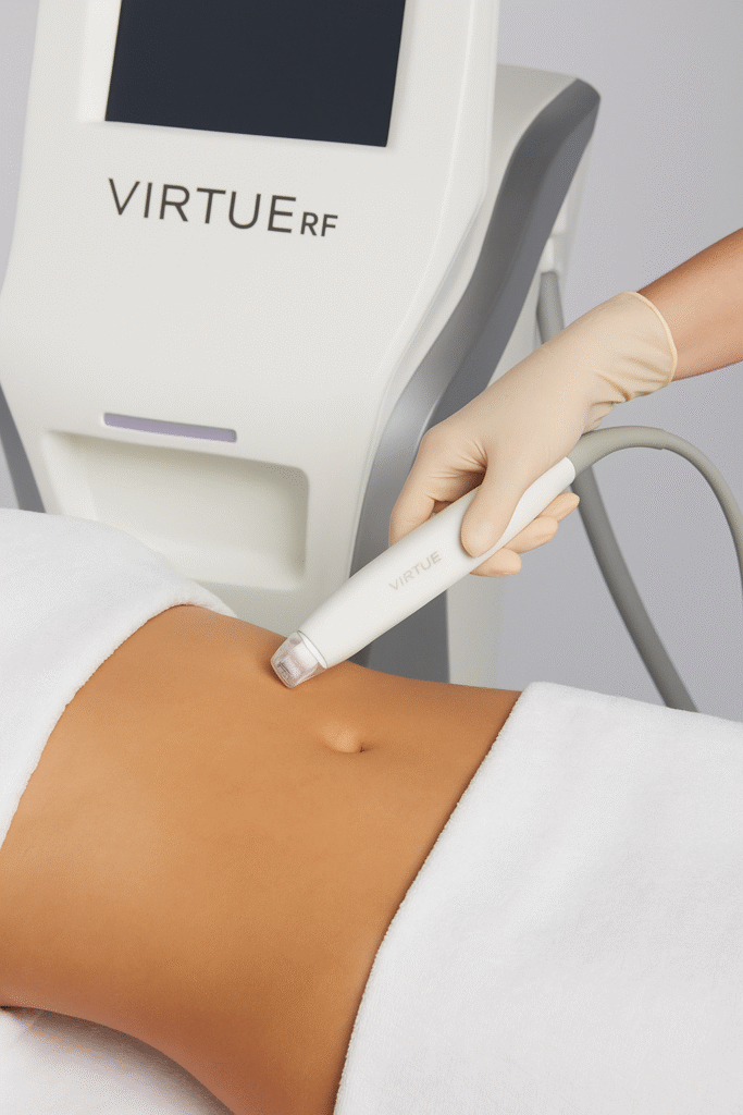 Dispositif de radiofréquence microneedling VirtueRF en cours d'utilisation