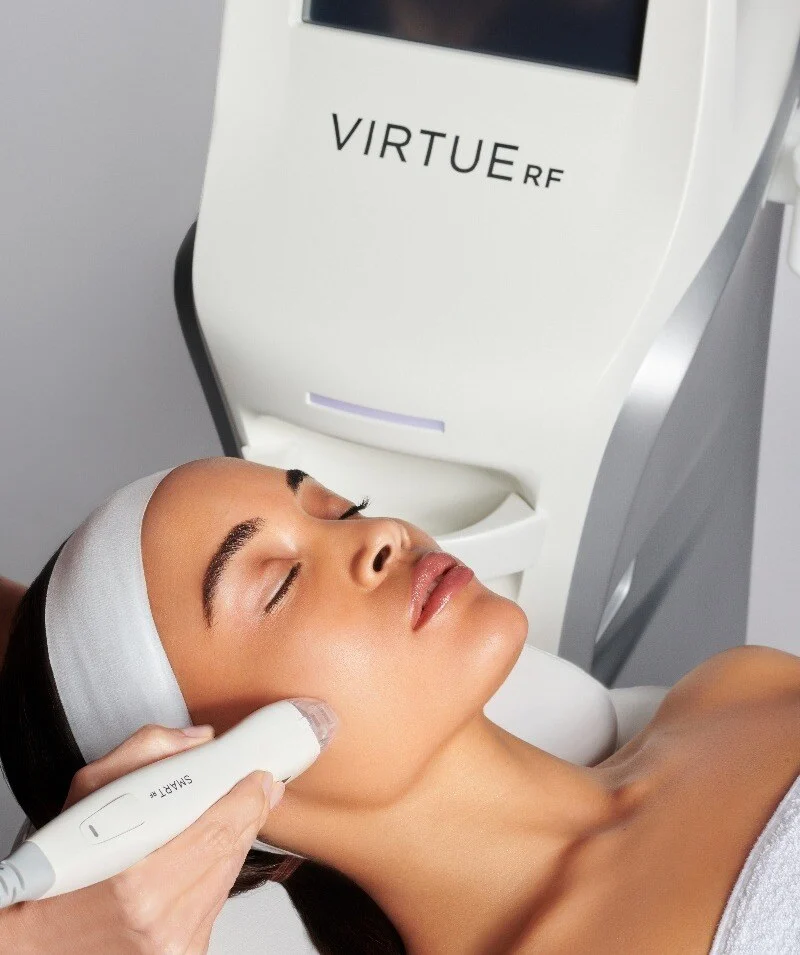Séance de radiofréquence microneedling réalisée sur le visage d'une patiente